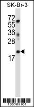 LIN52 Antibody (N-term )
