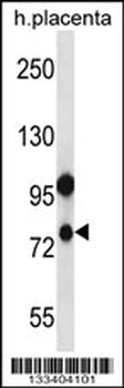 NLRP10 Antibody (C-term)