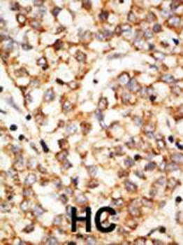 Apobec1 Antibody (N-term)