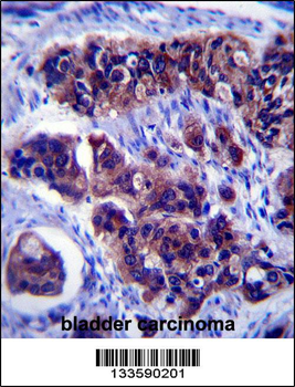 ZDHHC24 Antibody (C-term)
