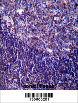 CD5 Antibody (Center)