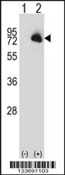 BTK Antibody (N-term)