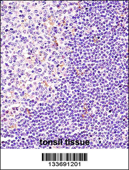 BTK Antibody (N-term)