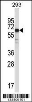SYT6 Antibody (C-term)