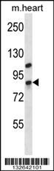 DHX32 Antibody (Center)