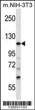 TUBGCP5 Antibody (N-term)