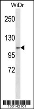 ZNF836 Antibody (N-term)