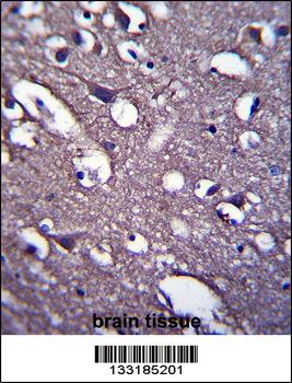 PRR18 Antibody (C-term)