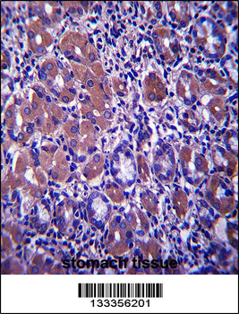 B4GALNT3 Antibody (Center)