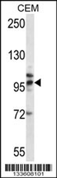TLR2 Antibody (Center)