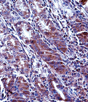 MCL1 Antibody (Center)