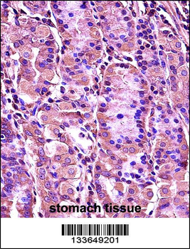 SYT1 Antibody (C-term)