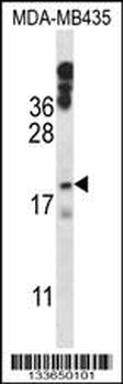HIST1H1E Antibody (N-term)