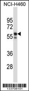 KRT6B Antibody (Center)