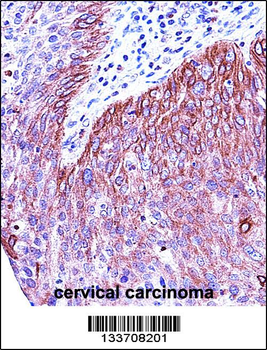 KRT6B Antibody (Center)