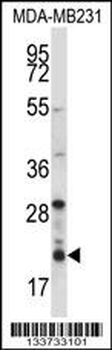 HIST1H1D Antibody (Center)
