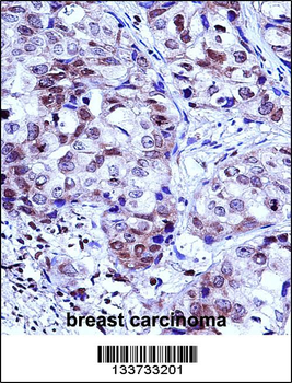 HIST1H1D Antibody (Center)