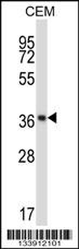 NFKBIB Antibody (C-term)
