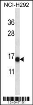 S100A7 Antibody (N-term)