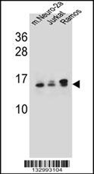 UBE2E2 Antibody (N-term)