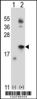 IL21 Antibody (C-term)