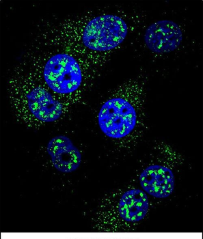 MGMT Antibody (N-term)