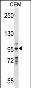VAV1 Antibody (Center)