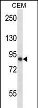 CAPN11 Antibody (Center)