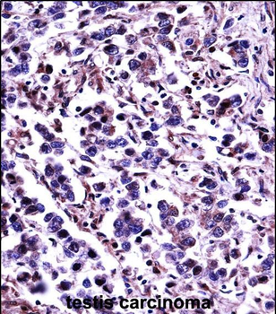 CAPN11 Antibody (Center)