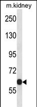 KCNC2 Antibody (C-term)