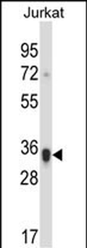 KIR2DS1 Antibody (Center)