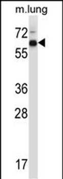 Mouse Mknk2 Antibody (N-term)
