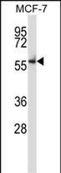 Mouse Nlk Antibody (C-term)