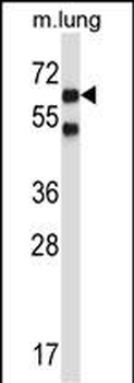 Mouse Nlk Antibody (C-term)