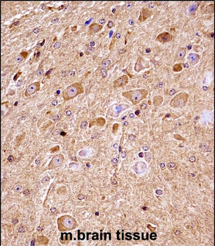 Mouse Nlk Antibody (C-term)