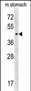 CHST14 Antibody (Center)
