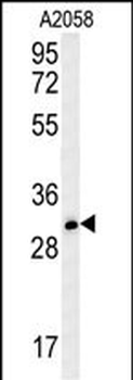 TRI73 Antibody (C-term)