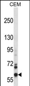 NOX5 Antibody (C-term)