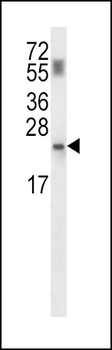 PPCDC Antibody (N-term)
