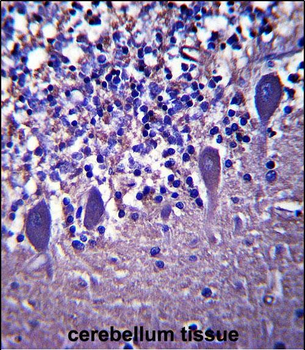 LRRC8B Antibody (N-term )