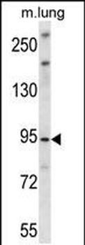 UNC45B Antibody (N-term)