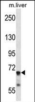 IL1R1 Antibody (C-term)