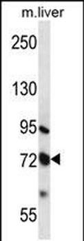 MMP17 Antibody (C-term)
