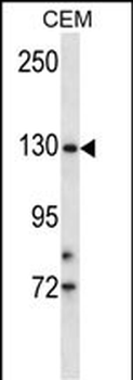 TMPRSS9 Antibody (N-term)