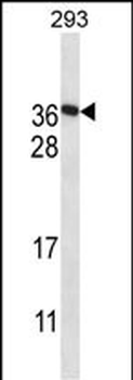F122A Antibody (Center)
