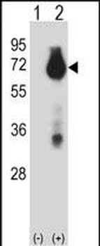 BIRC3 Antibody (N-term)