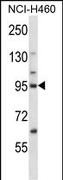 KIF2C Antibody (N-term)