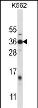 DLX4 Antibody (Center)