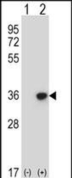 DLX4 Antibody (Center)