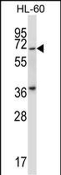 Mouse Pkmyt1 Antibody (N-term)